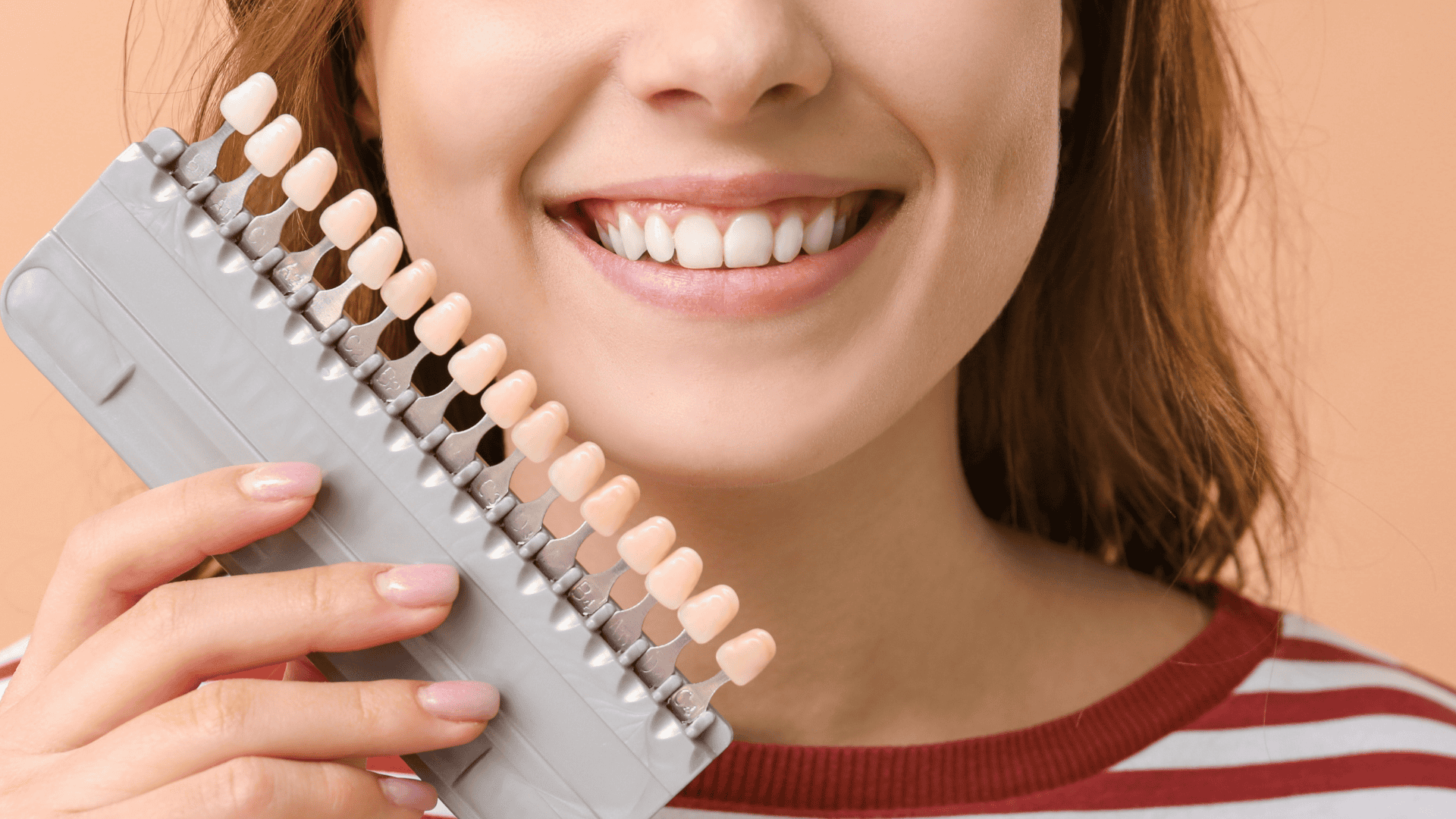 Professional Teeth Whitening in Tarzana