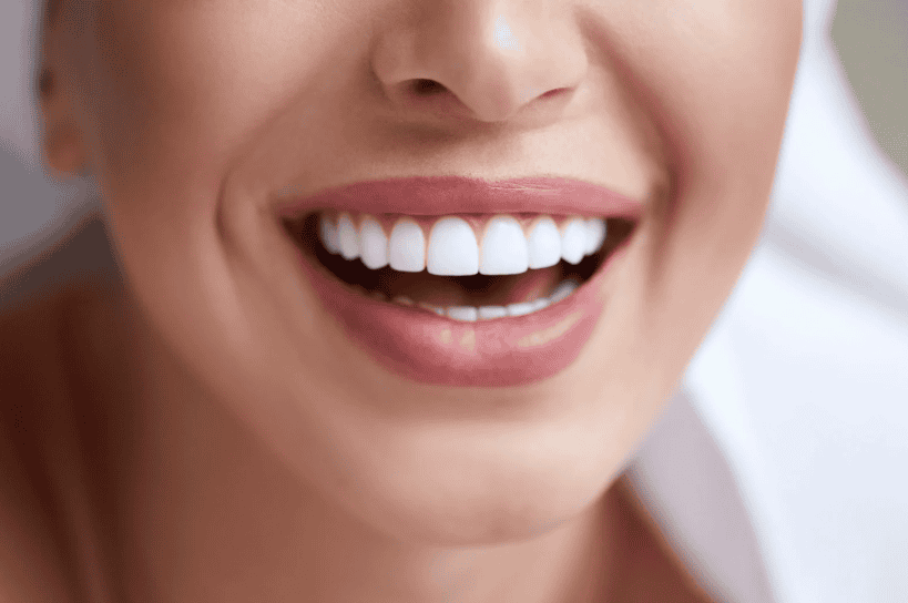 Cosmetic Dentistry in Tarzana
