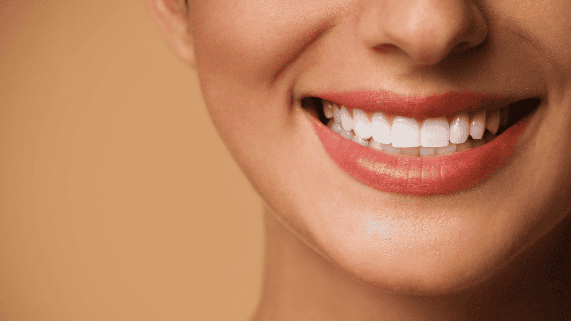 Dental Bonding by Dental Plus Tarzana