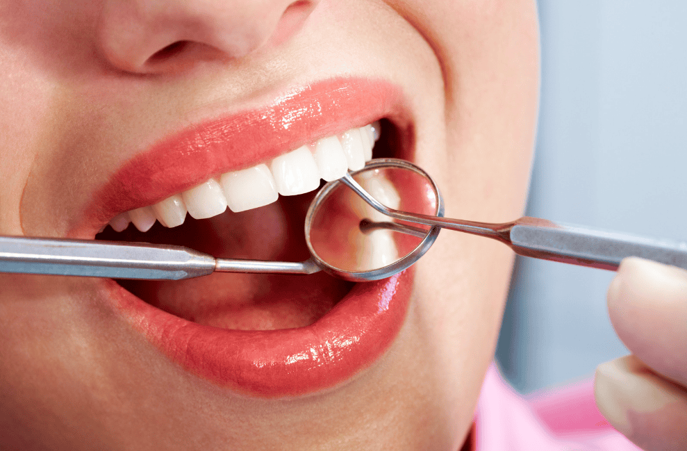 Fix chipped, cracked or stained teeth in one visit. Affordable dental bonding in Tarzana with same-day results. No wait, no lab work. Call (818) 881-2333.