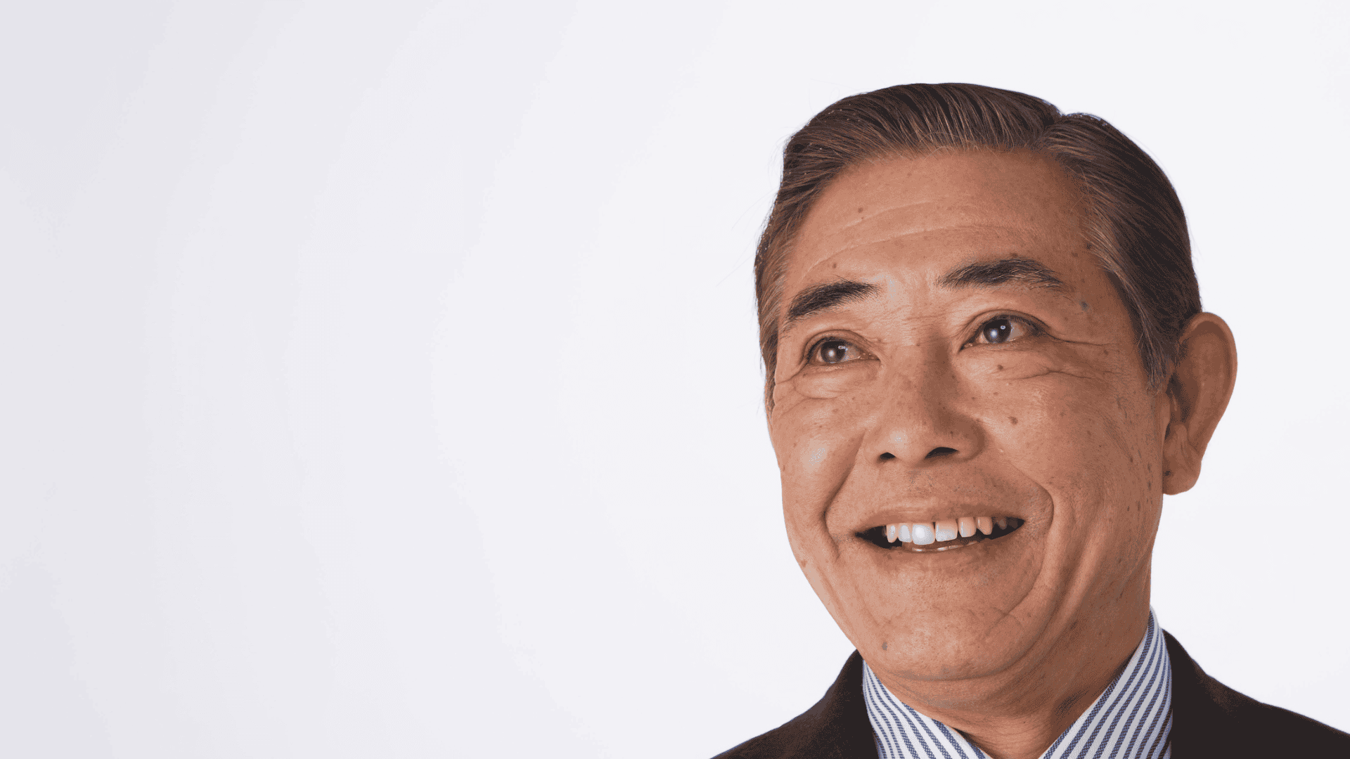 Dental Bridges by Dental Plus Tarzana