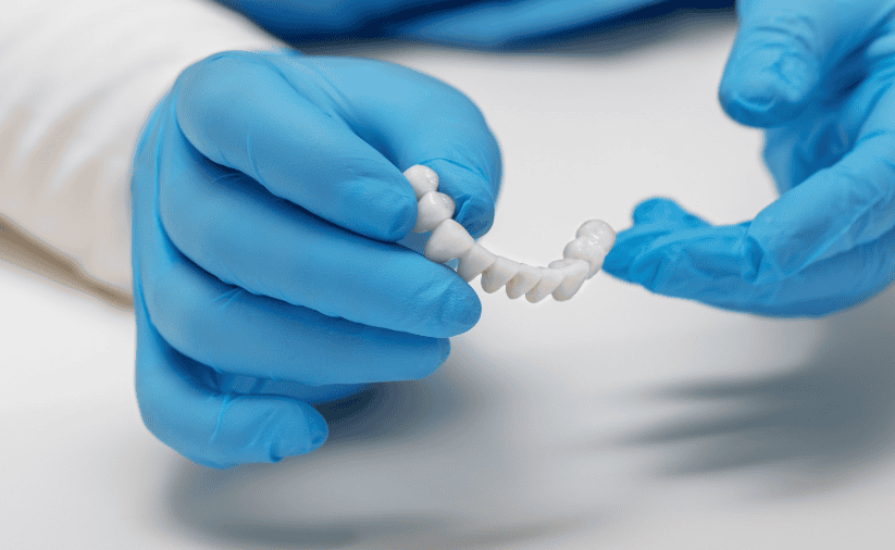 Dental Bridges in Tarzana CA