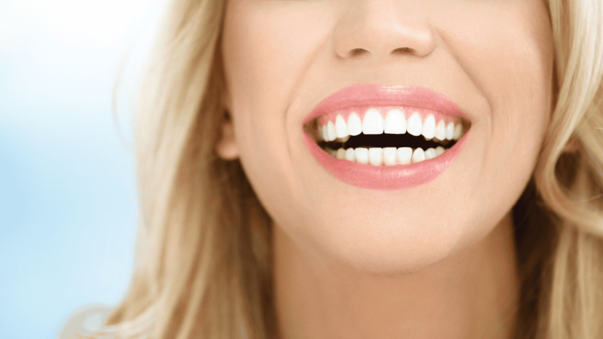 Veneers in Tarzana